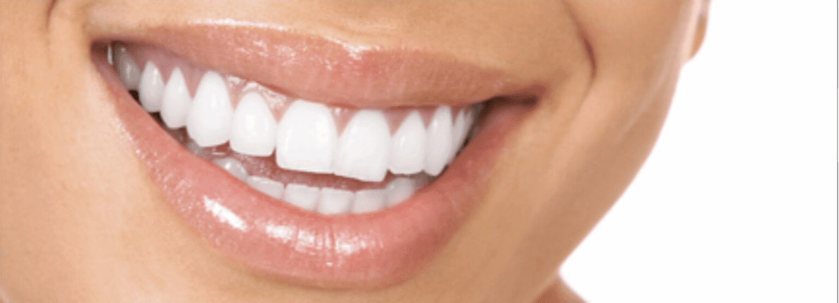 Beautiful Smile - Laser Dentistry